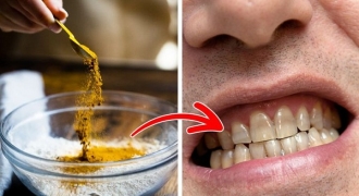 6 thói quen hàng ngày làm răng ố vàng, xỉn màu
