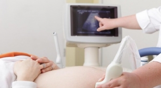 Uống thuốc tránh thai khẩn cấp vẫn dính bầu, thai nhi có bị ảnh hưởng?