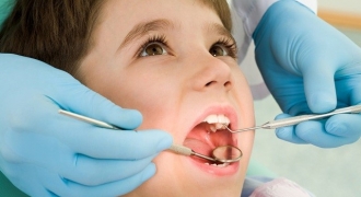 Nguy cơ sâu răng sớm ở trẻ em: Dấu hiệu nhận biết và cách điều trị nhanh phục hồi