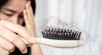 Chuyên gia chỉ ra 5 lý do khiến tóc gãy rụng đến mức 