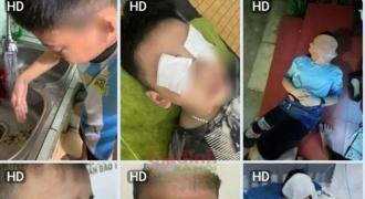 Hàng loạt học sinh Hà Nội bị dị ứng thuốc diệt muỗi: Chuyên gia nói gì?