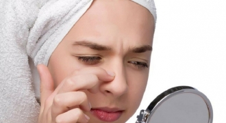 5 sai lầm cần tránh khi chăm sóc da khiến mụn đầu đen đeo bám