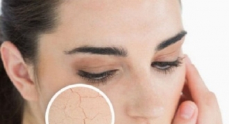 6 cách chăm sóc da khô hiệu quả ngay tại nhà