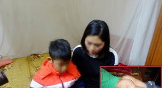 Thêm vụ bé trai 9 tuổi ở Hà Nội nghi bị bố đẻ bạo hành dã man