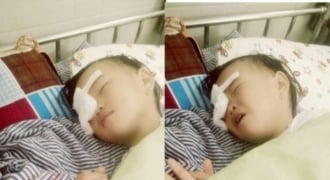 Nghệ An: Bé gái 2 tuổi bị gà đá hỏng một bên mắt