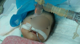 Cháu bé 8 tháng tuổi nghi tiêm nhầm thuốc diễn biến bệnh nặng, nguy hiểm tính mạng