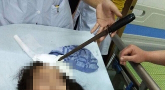 Vụ nữ sinh bị bạn phi dao trúng trán ở Hà Nam: Bộ GD&ĐT chỉ đạo 'nóng'