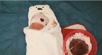 Bộ Y tế lên tiếng về sự việc 2 mẹ con sản phụ tử vong do sinh 'thuận tự nhiên'