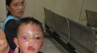 Bé 2 tuổi ở Nghệ An bị cha dượng bạo hành dã man
