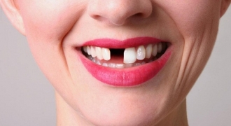 Ham rẻ làm răng sứ không đảm bảo chất lượng cẩn thận hỏng cả hàm răng