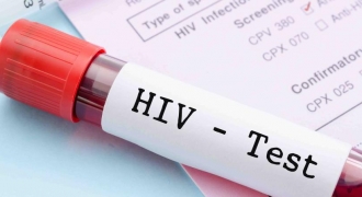 Những biện pháp an toàn ban đầu đối với người mới nhiễm HIV