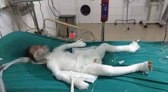 Bé trai 6 tuổi ở Hà Nội bị bố dượng tẩm xăng đốt bỏng 98% đã tử vong