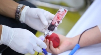 Hiến máu cách nhau bao nhiêu lâu để tốt cho sức khỏe?