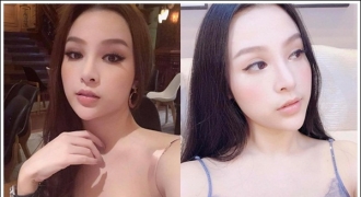 Hot girl Hà Thành “ Huyền Baby” chia sẽ bí quyết làm đẹp bằng phương pháp tiêm filler