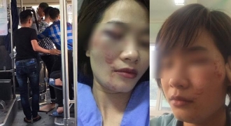 Nhóm đàn ông xăm trổ đánh nữ phục vụ xe buýt nhập viện