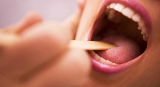 Những dấu hiệu trên lưỡi cảnh báo sức khỏe không bình thường