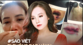 Sao Việt bị chồng bạo hành: Kiều Trinh chấn thương hộp sọ, Hoa hậu Diễm Hương định tự tử