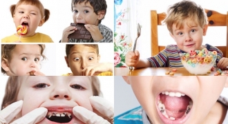 Vì sao trẻ em thường bị sâu răng?