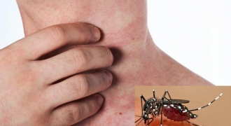 8 giải pháp phòng chống sốt xuất huyết tại địa phương