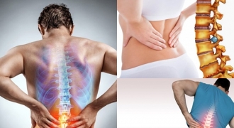 8 nguyên nhân gây đau lưng, điều thứ 5 nhiều người không ngờ tới