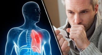 5 cách ngăn ngừa ung thư phổi, điều số 1 cần lưu tâm
