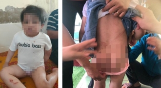 Bé gái 4 tuổi tại Hà Tĩnh bị bạo hành: Sự thật từ lời khai của dì ruột