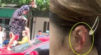 Đập phá xe ô tô, cắn đứt tai người khác vì ghen tuông tại Thanh Hoá: Người vợ đối diện tội danh nào?