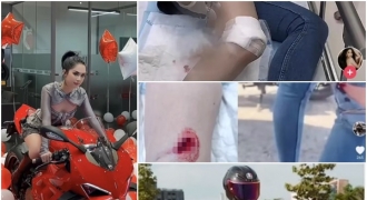 Ngọc Trinh gặp nạn khi lái moto, băng bó khắp người, di chuyển bằng xe lăn