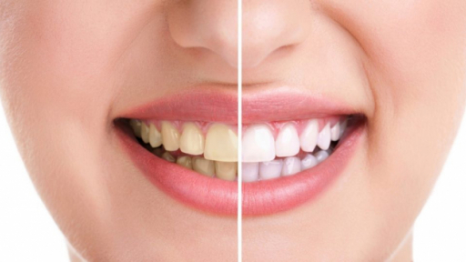 Các thói quen tưởng chừng như vô hại nhưng làm răng bạn ố vàng mỗi ngày