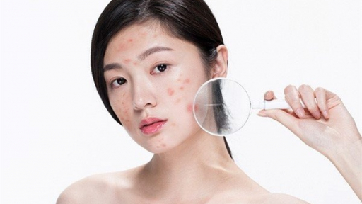 Những bí kíp sở giúp bạn sở hữu làn da sạch đẹp nhưng không tốn tiền