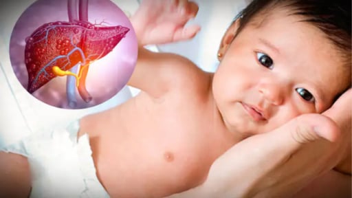 Dấu hiệu nào nhận biết trẻ bị viêm gan bí ẩn?