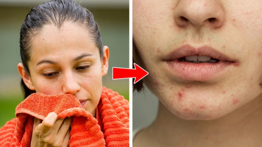 Mụn trứng cá mọc 8 vị trí này cảnh báo cơ thể đang 