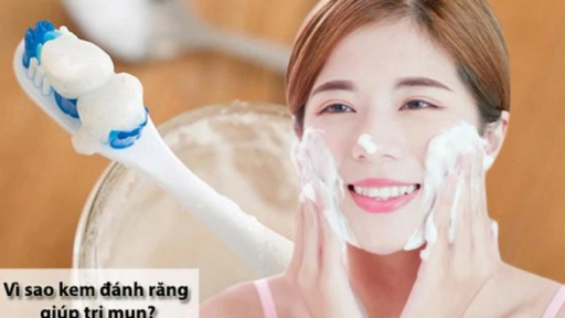 Bôi kem đánh răng lên mụn có được không, có gây hại tới da không?