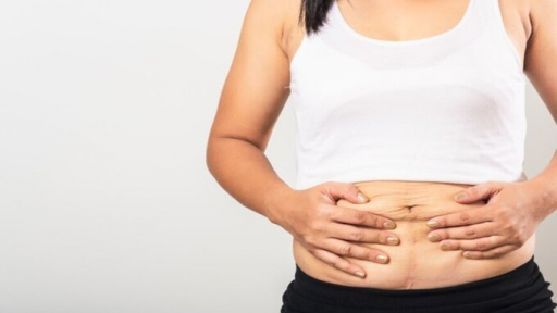 Vì sao người gầy bụng vẫn tích đầy mỡ?