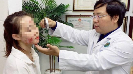 Tự hủy hoại gương mặt sau liệu trình làm đẹp cấp tốc đón Tết từ 