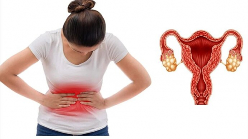 Thói quen ăn uống tưởng chừng vô hại lại gây vô sinh ở phụ nữ
