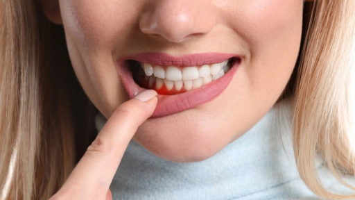 Đau tim, đột quỵ do... lười đánh răng