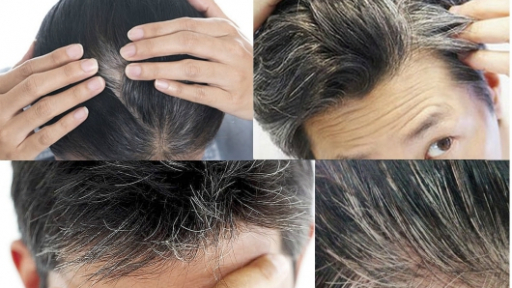 Những loại thực phẩm giúp tóc đen bóng, tránh bạc sớm