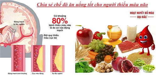 Chữa thiếu máu não bằng kinh nghiệm dân gian