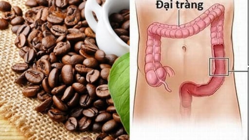 Lợi và hại quanh vấn đề dùng nước cà phê 