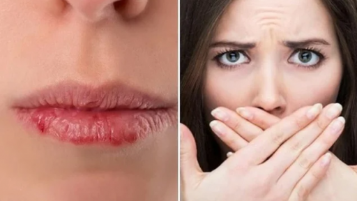 5 sai lầm khiến môi khô, nứt nẻ ngày đông