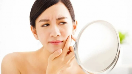 Vị trí mụn trứng cá tiết lộ điều gì về sức khỏe?