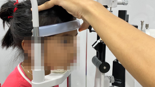 Rận mi chi chít trên mắt bé gái 5 tuổi