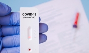 Người dân có nên mua và sử dụng dụng cụ test nhanh COVID-19?
