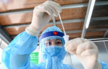 Thêm 266 ca mắc COVID-19, Việt Nam vượt 9.000 ca nhiễm trong nước