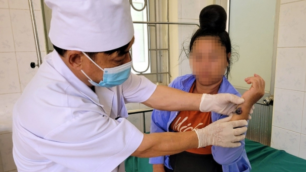 14 người mắc nhiệt thán do ăn thịt trâu, bò bệnh