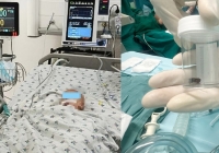 Hai bệnh viện phối hợp lấy dị vật 'kẹt' đường thở bệnh nhi 8 tháng tuổi