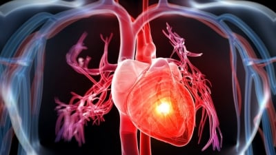 Bệnh tim mạch: Định nghĩa, nguyên nhân và triệu chứng