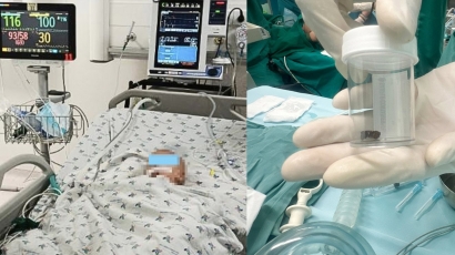 Hai bệnh viện phối hợp lấy dị vật 'kẹt' đường thở bệnh nhi 8 tháng tuổi