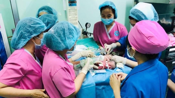 Gần 100 y bác sĩ sẽ phẫu thuật tách dính cặp song sinh